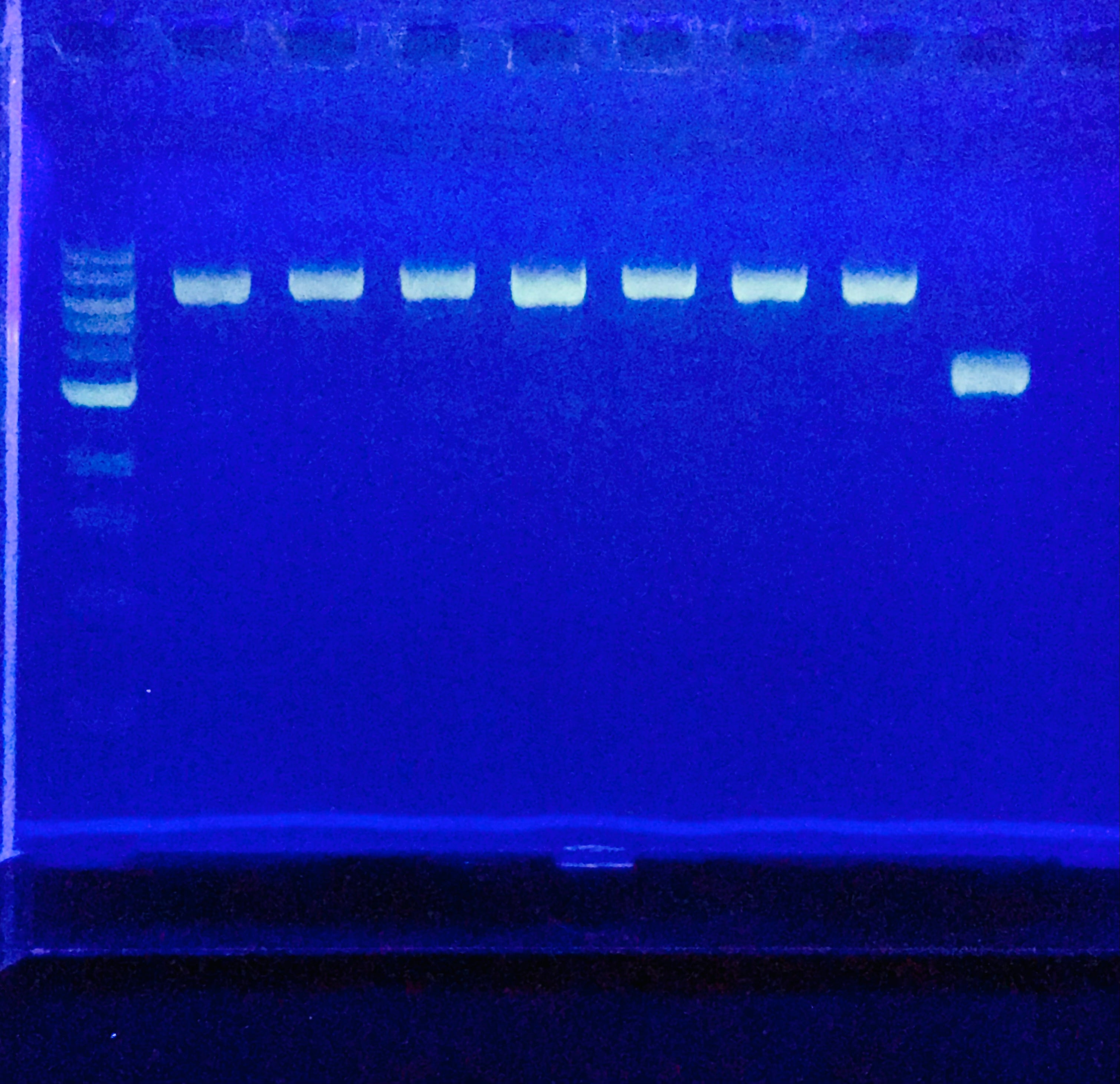 Dna Example Gel Gel Electrophoresis Kit: Learning DNA Ladders – Amino Labs