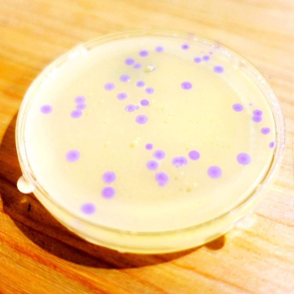 preserved petri dish with bacteria using Amino Labs Keep it kit - preservation kit -biotechnology kits - Learn and practice your genetic engineering, bioart and living art skills while discovering the answers to the most common biology, biotechnology, bioart, life science, biohacking and genetic engineering questions as part of getting started with your personal biotechnology science project.